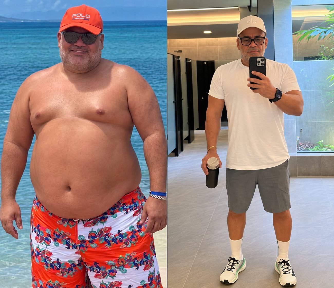 Antes e depois de paciente do Protocolo DS